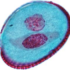 Pollen grain showing generative cell inside of tube cell of Lilium