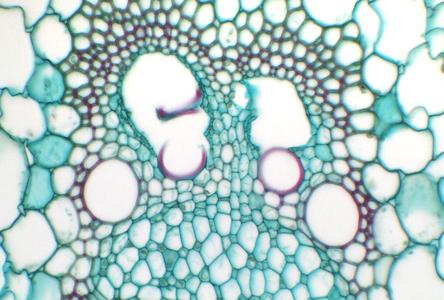 Xylem with protoxyem lacunae in cross section of Zea stem