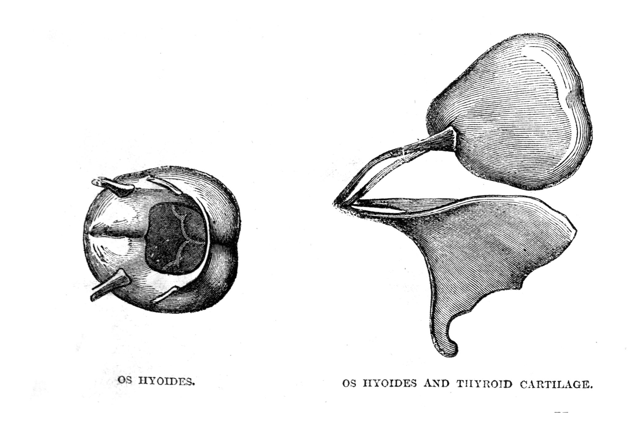 Os Hyoides and Os Hyoides and Thyroid Cartilage