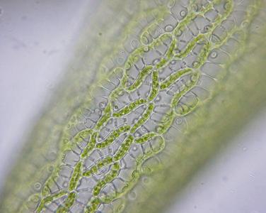 Cells of the "leaf" of Sphagnum moss