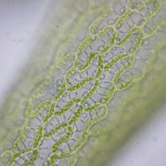 Cells of the "leaf" of Sphagnum moss