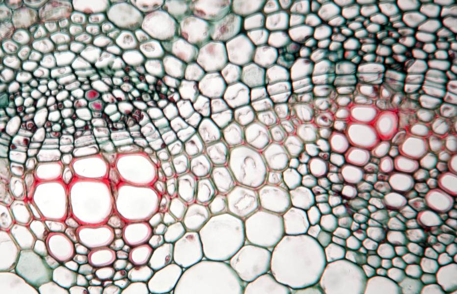 ‎Interfascicular cambium in cross section of Medicago stem UWDC UW