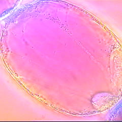 Stamen hair cell - detail of a dynamic cell of Setcreasea : raphide crystals can be viewed in the vacuole moving due to Brownian motion