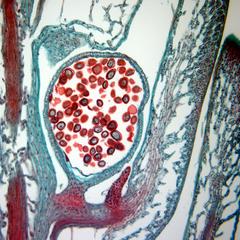 Longitudinal section of strobilus showing a microsporangium of Selaginella