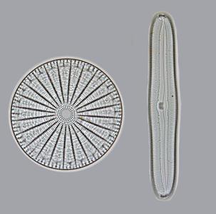 Diatoms - valve view of centric and pennate diatoms