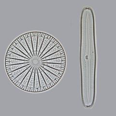 Diatoms - valve view of centric and pennate diatoms