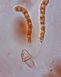 Cedar apple rust - germinating teliospores from infection on cedar view of young basidia