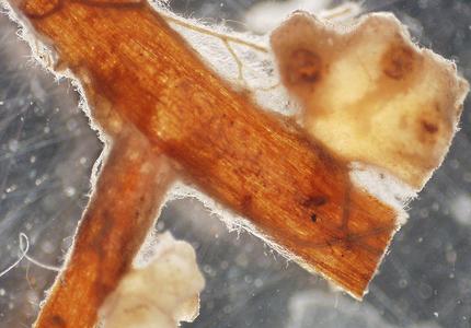 Ectomycorryzae of pine view of mycelium