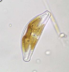 Diatoms - Cymbella, a pennate diatom