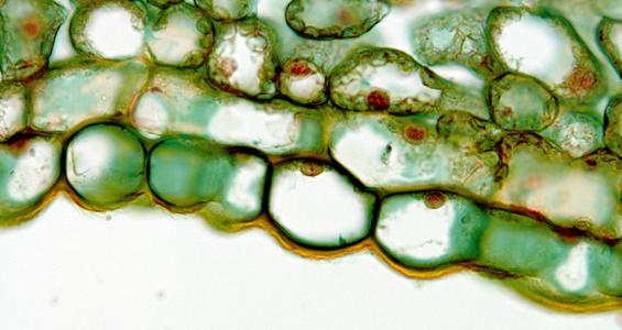 Epidermis in cross section of a lilac leaf - 100x objective
