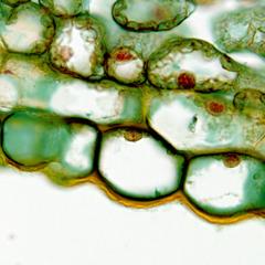 Epidermis in cross section of a lilac leaf - 100x objective