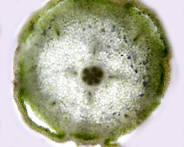 Cross section of a stem of shining club moss