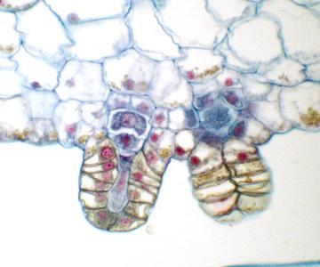 Cross section of a fern gametophyte - achegonia seen in profile
