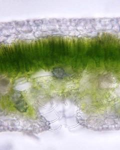 Fresh cross section of a leaf of Nerium oleander with druses