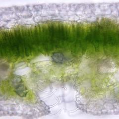 Fresh cross section of a leaf of Nerium oleander with druses
