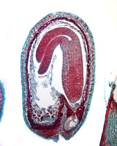 Ovule with torpedo stage embryo - embryogenesis in Capsella with cellular endosperm
