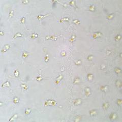 Volvox focus above cells - flagella visible