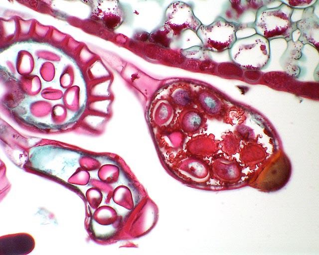 Holly fern, Cyrtomium falcatum - section of a sporangium -  annulus in cross section