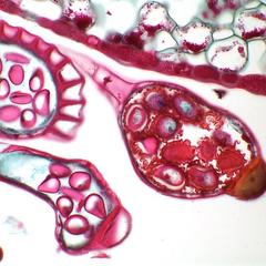 Holly fern, Cyrtomium falcatum - section of a sporangium -  annulus in cross section