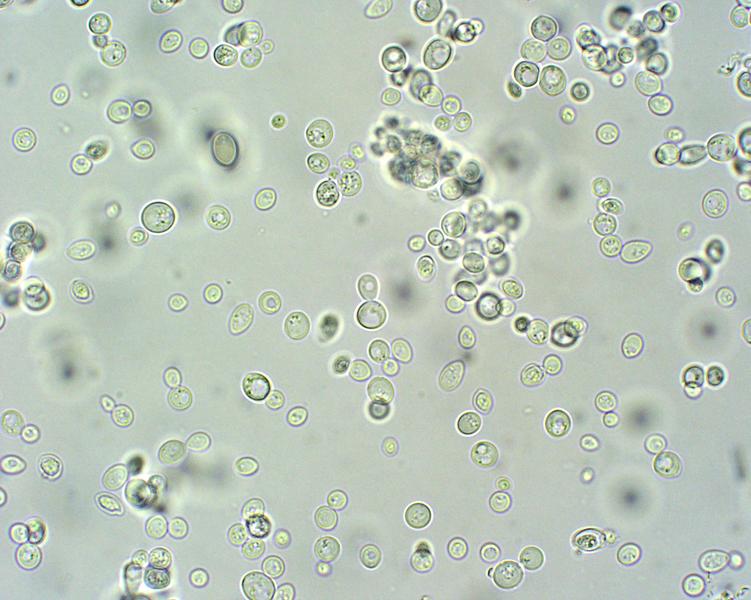 Yeast Cells Under Light Microscope