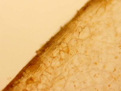 Periderm in a cross section of a carrot root