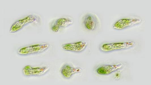 Euglena - a composite of different views of the same cell illustrating euglenoid motion- 100x objective DIC illumination