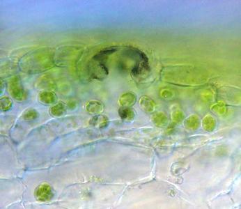 Fresh cross section through thallus  of a Marchantia gametophyte showing detail of an air pore