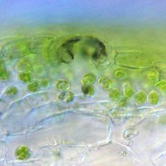 Fresh cross section through thallus  of a Marchantia gametophyte showing detail of an air pore