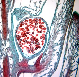 Selaginella - microsporophyll in longitudinal section