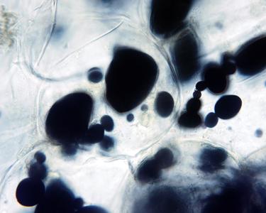 Potato tuber tissue 60x objective - view of starch grains stained with iodine