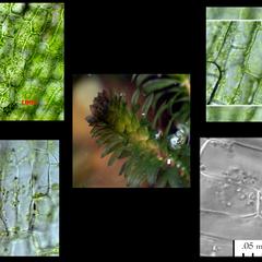 Elodea leaf cells composite of various views