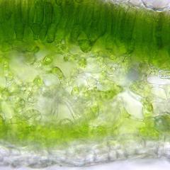 Fresh cross section of a leaf of Nerium oleander - view of palisade and spongy parenchyma