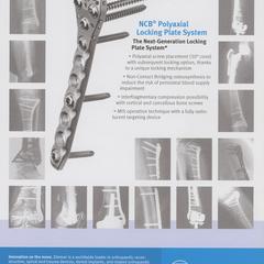 NCB Polyaxial Locking Plate System advertisement