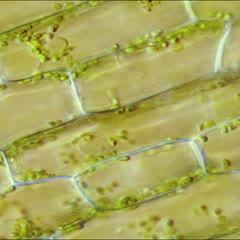 Views of Elodea tissue  with DIC illumination chloroplasts, mitochondria and a nuclei with visible nucleoli : 400x objective