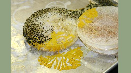 Plasmodial slime molds - plasmodium and sporangia