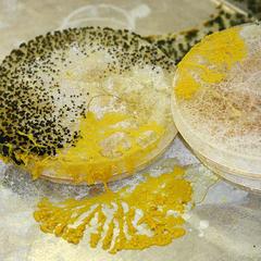 Plasmodial slime molds - plasmodium and sporangia