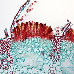 Cross section of an infected leaf of wheat through an telium with teliospores