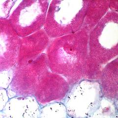 Infected cortical cells in cross section of root nodule of pea