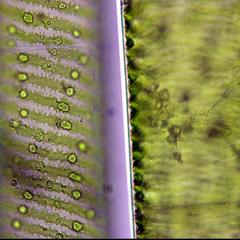 Spirogyra - two views of the same cell at different planes of focus
