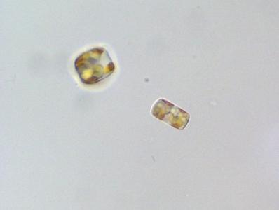 Diatoms - valve and girdle view of a living centric diatom