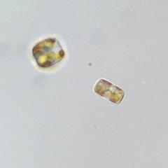 Diatoms - valve and girdle view of a living centric diatom