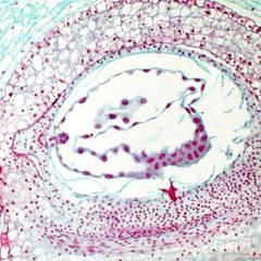 Young embryo with endosperm of Lilium