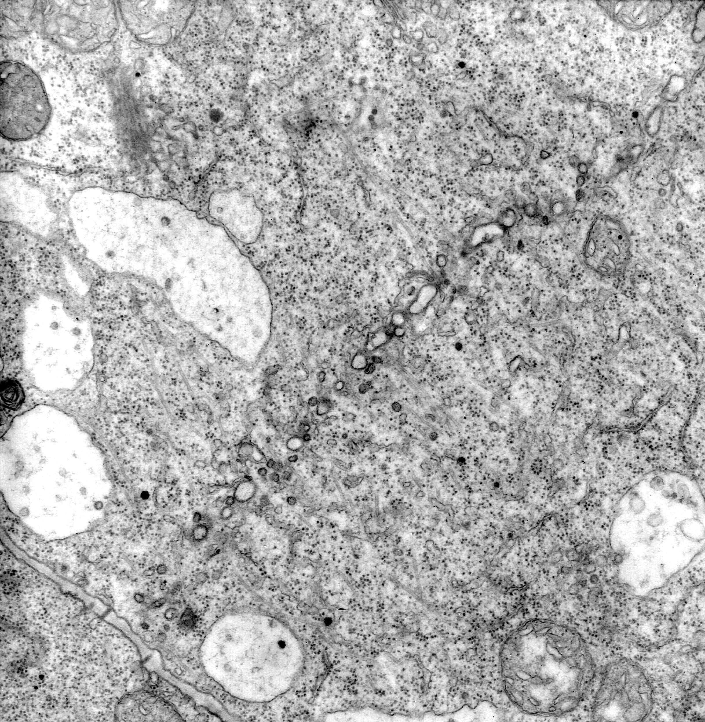 ‎Phragmoplast with cell plate and mitochondria UWDC UWMadison