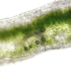 Cross section of a leaf of carnation