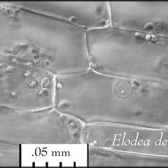 Nucleus with visible nucleolus with a linear scale in an Elodea cell