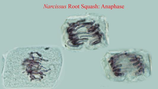 Anaphase cell from a Narcissus root squash