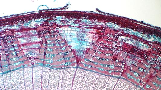 Secondary phloem in a cross section of a three-year old Tilia stem