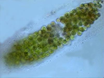 Hydrodictyon - older non-motile zoospores