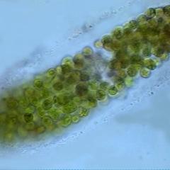 Hydrodictyon - older non-motile zoospores