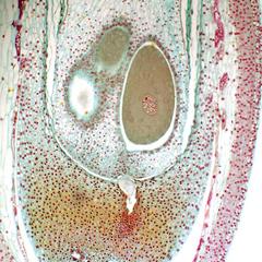 Pine ovule after fertilization - pollen tube and zygote